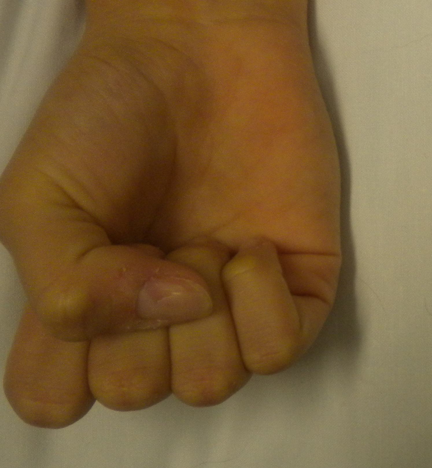 Finger rotation normal